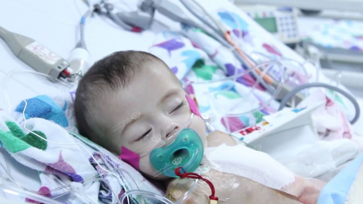 (23)عملية أجراها الفريق الأمريكى لجراحة قلب الأطفال في طبرق
