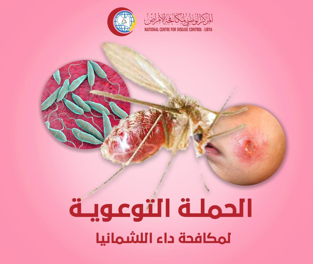 المركز الوطني لمكافحة الأمراض يطلق الحملة التوعوية حول داء (اللشمانيا)