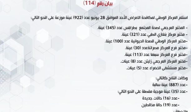 المركز الوطني لمكافحة الأمراض يعلن نتائج آخر تحاليل فيروس (كورونا) ويسجل (35) حالة موجبة