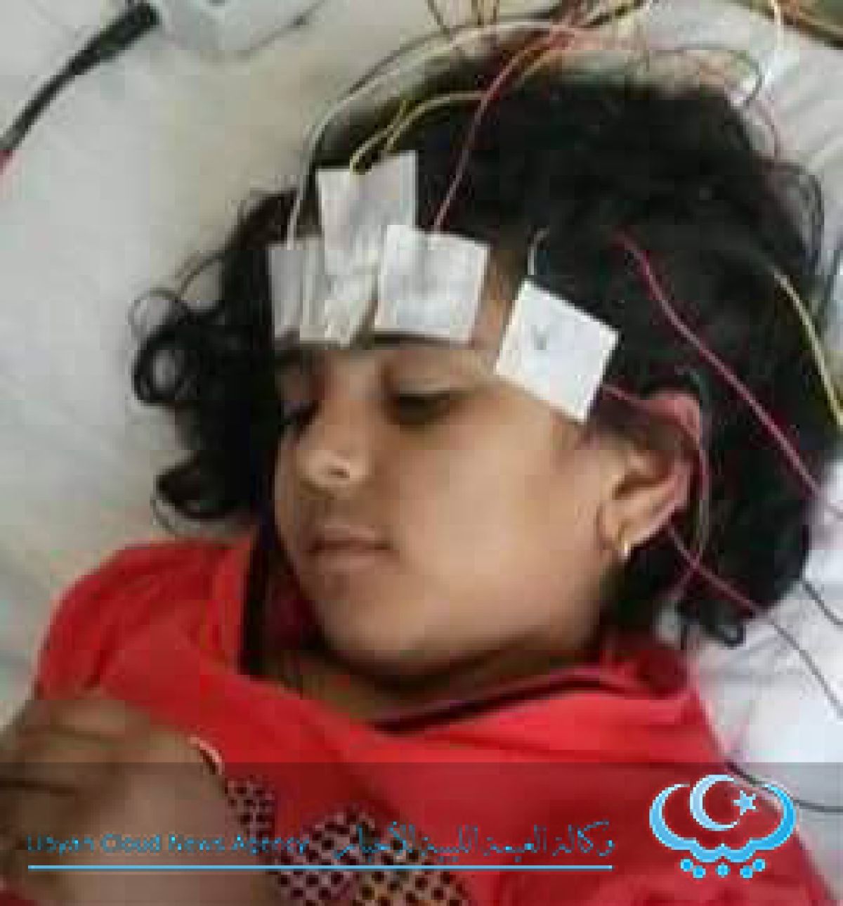 الطفلة الليبية المهاجرة تجري عملية زرع نخاع